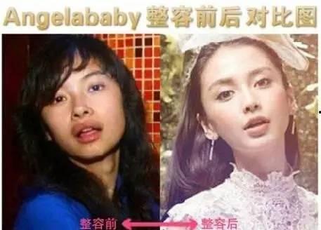 香港以前整容明星,美丽蜕变背后的故事