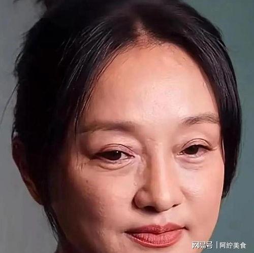 痘坑最严重的明星,揭秘最严重痘坑明星的护肤历程