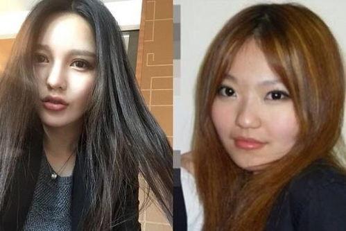 容东王妃整形吃瓜,揭秘明星美容背后的真相